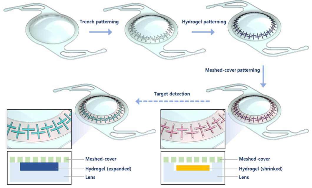 Development of SIOL (Smart Intra Ocular Lens) for Neurodegenerative <br>Disease (Alzheimer, Parkinson, Apoplexy) related Biomarker Detection and Monitoring